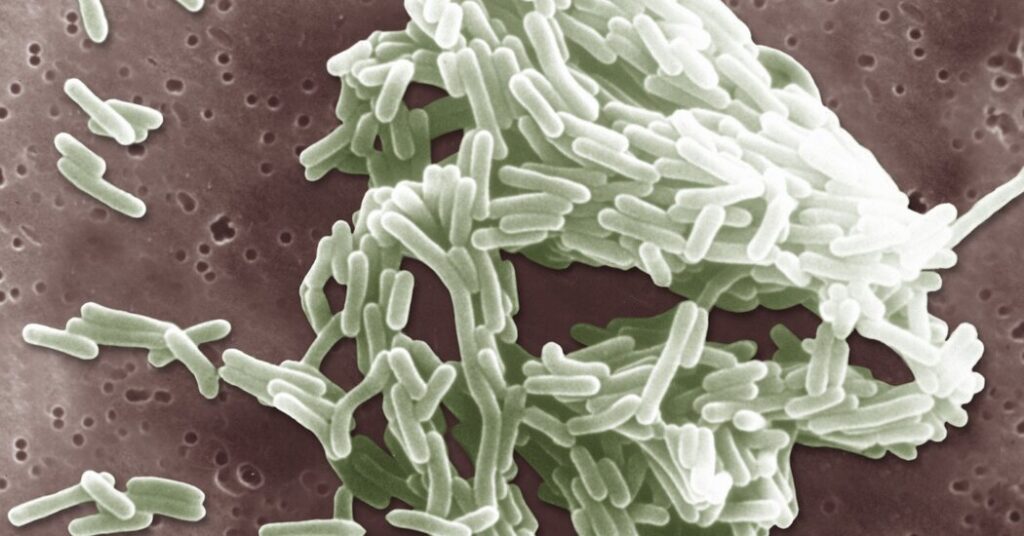 listeria-outbreak-tied-to-deli-sliced-meat-kills-at-least-2,-cdc.-says